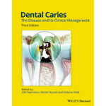 Dental Caries: The Disease and Its Clinical Management. Kurssikirja lääketieteelliseen.