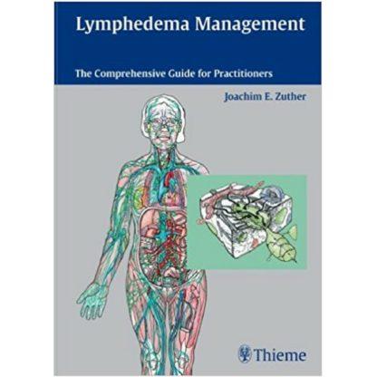 lymphedema management