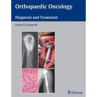 Orthopaedic Oncology 9781588905239