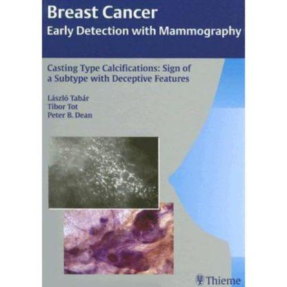 In Breast Cancer: The Art and Science of Early Detection with Mammography-Perception, Interpretation, Histopathologic Correlation, Lszl Tabr, one of the world?s most renowned mammographers, has shared his decades of experience in presenting the fundamentals of perception and interpretation of mammographic images. This is the second volume in a series of books written by the team of Tabr, Tot, and Dean describing breast cancer in its earliest phase according to the imaging findings and correlating these findings with sophisticated histopathologic images and patient outcome. This volume covers a particularly troublesome subtype of breast cancer characterized by casting type calcifications. Highlights: Extensive coverage of the morphology and outcome of this deceptive breast cancer subtypeNearly 1000 illustrations of stunning quality showing the full range of manifestationsPhotomicrographs of large, thin-section pathology slides and unique 3D pathology images which are carefully correlated with mammographic images to explain why mammograms appear as they doStereoscopic images that demonstrate normal breast structures and the distortion caused by this unique malignant processPresentation of an original theory of neoductgenesis to explain the surprising disease outcome all too frequently observedScientific rationale for using individualized treatment methods which include the mammographic prognostic features 9781588905802