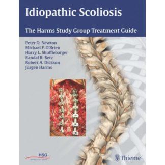 Idiopathic Scoliosis 9781604060249