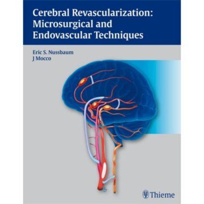 Cerebral Revascularization: Microsurgical and Endovascular Techniques 9781604062632
