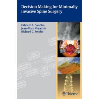 Decision Making for Minimally Invasive Spine Surgery 9781604062663