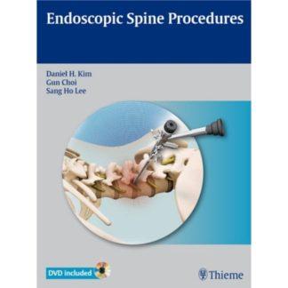 Endoscopic Spine Procedures 9781604063073