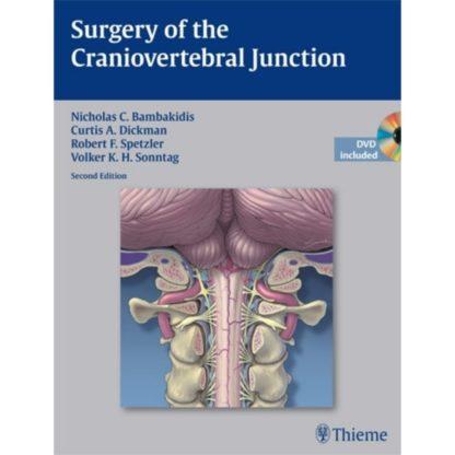 Surgery of the Craniovertebral Junction 9781604063387