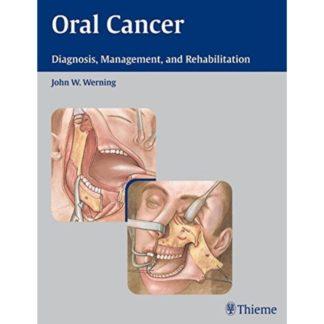 ORAL CANCER 9783131358110