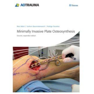 Minimally Invasive Plate Ostheosynthesis 9783131433923