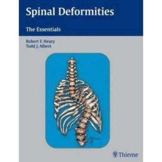 SPINAL DEFORMITIES - THE ESSENTIALS 9783131441218