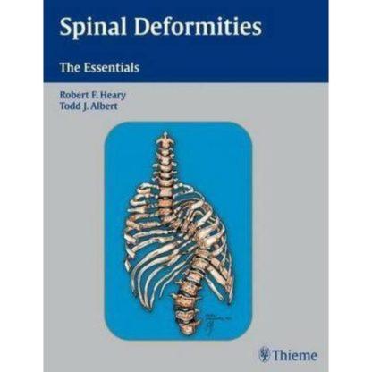 SPINAL DEFORMITIES - THE ESSENTIALS 9783131441218