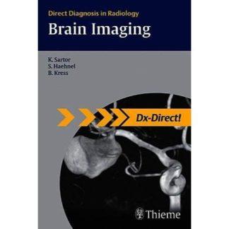 Brain Imaging: Direct Diagnosis in Radiology (DX-Direct Series) 9783131439611