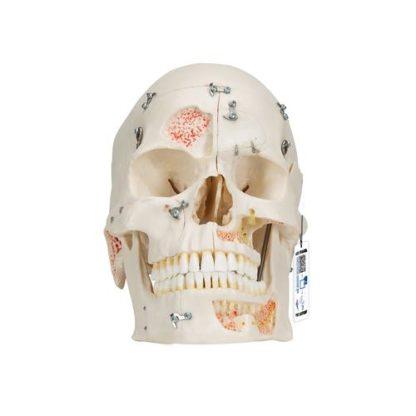 Purettava kallo malli A27_01_Deluxe-Human-Demonstration-Dental-Skull-Model-10-part-3B-Smart-Anatomy