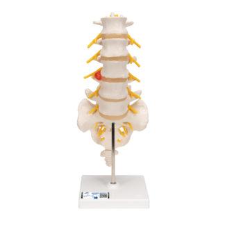 Lannerankamalli A76-5_01_1200_1200,1000150_Human_Lumbar_Spinal_Col