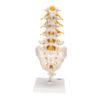 Lannerankamalli - Human Lumbar Spinal Column Model with Dorso-Lateral Prolapsed Intervertebral Disc - 3B Smart Anatomy - Image 6