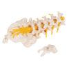 Lannerankamalli - Human Lumbar Spinal Column Model with Dorso-Lateral Prolapsed Intervertebral Disc - 3B Smart Anatomy - Image 2