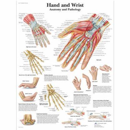 Käsi ja ranne kartta VR1171L_01_Hand-and-Wrist-Chart-Anatomy-and-Pathology
