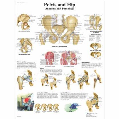 Lantio ja lonkka kartta VR1172L_01_Pelvis-and-Hip-Chart-Anatomy-and-Pathology