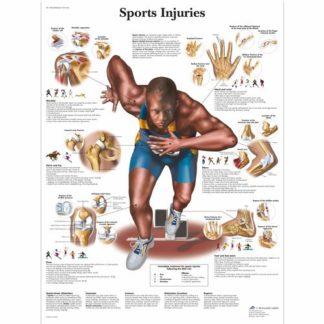 Urheiluvamma kartta VR1188L_01_Sports-Injuries-Chart